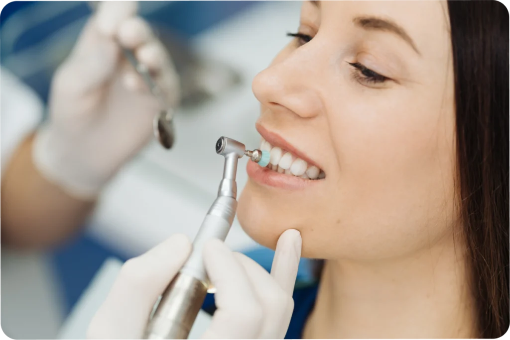 Entretien des facettes dentaires, conseils du dentiste à Strasbourg