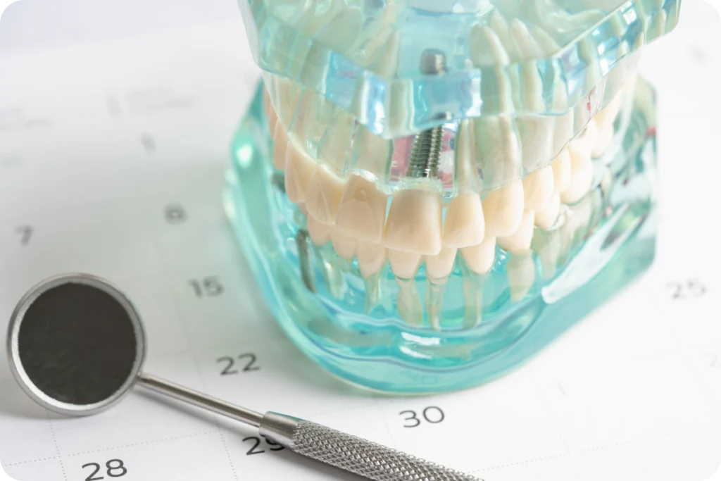 consultation implant dentaire strasbourg Implant dentaire breining