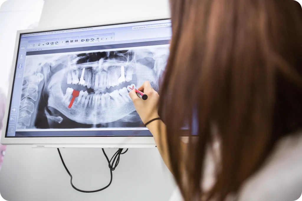 chirurgien-dentiste implant dentaire strasbourg Implant dentaire breining