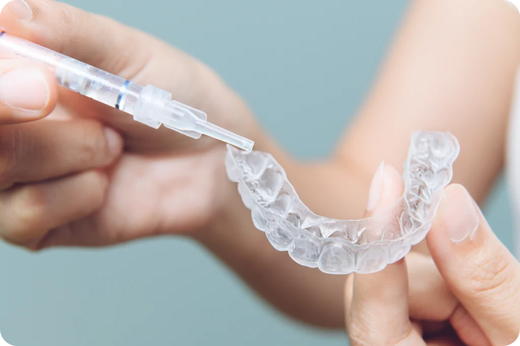 Gouttière de blanchiment dentaire sur mesure, dentiste à Strasbourg