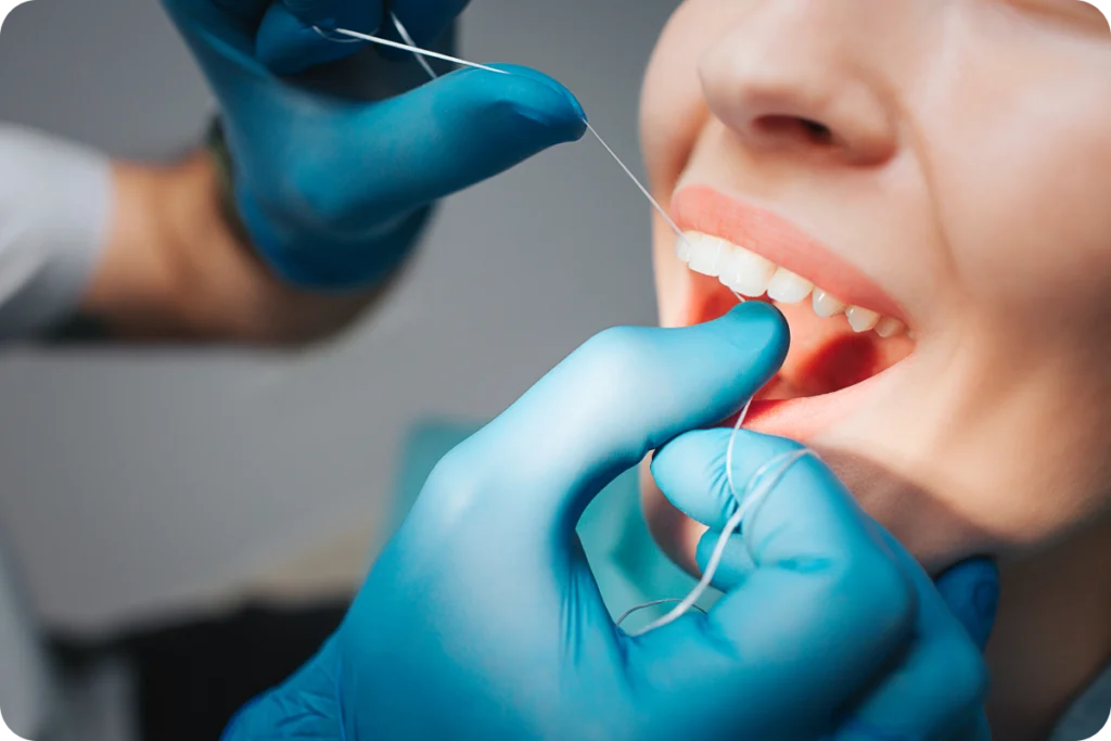 Démonstration de l'usage du fil dentaire, dentiste à Strasbourg