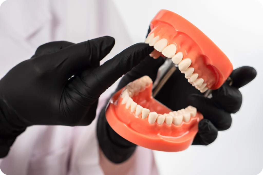 Bilan dentaire du sportif sur modèle, dentiste à Strasbourg